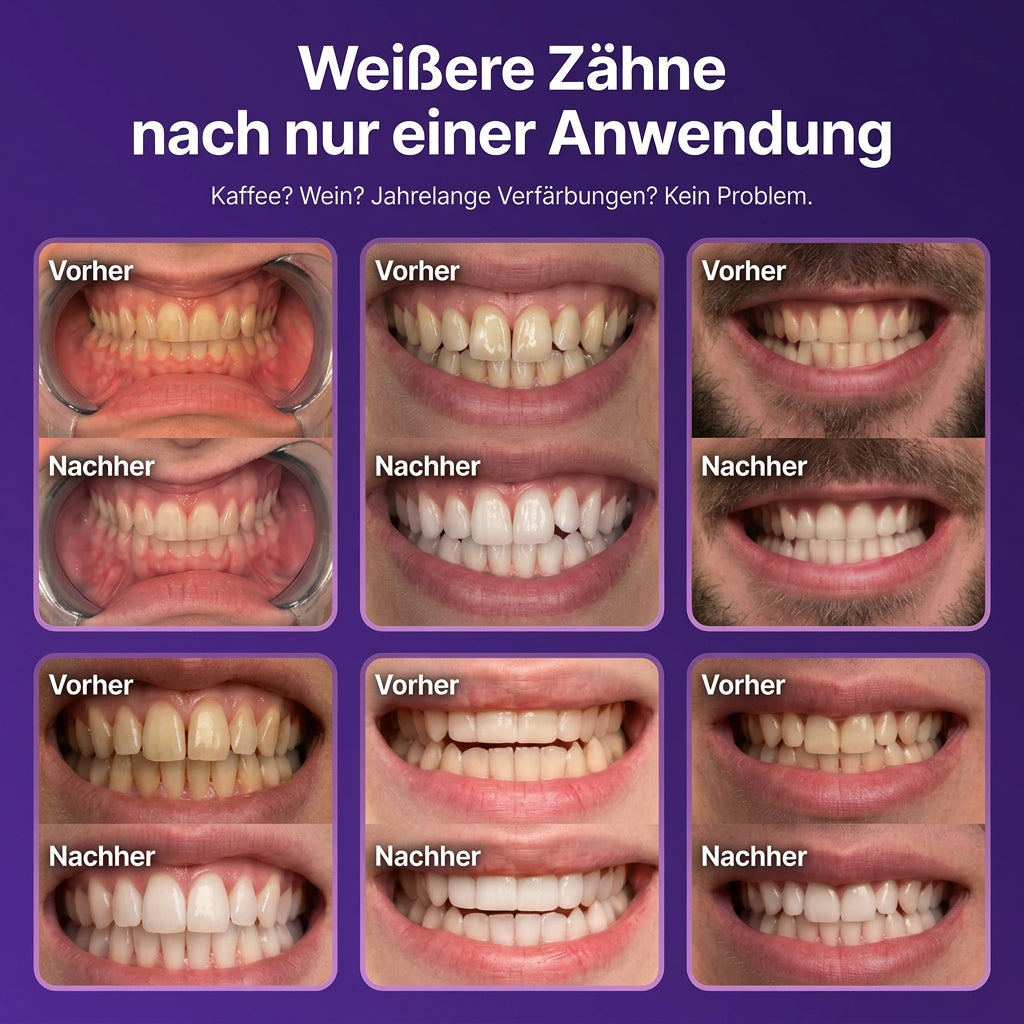 Whitening result close-up