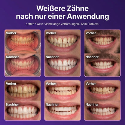 Whitening result close-up